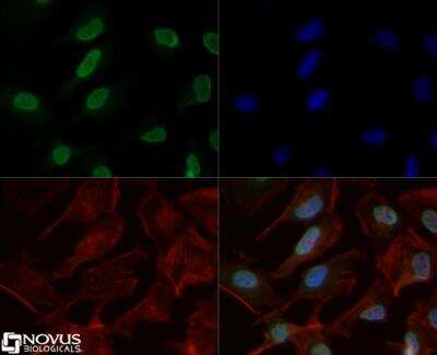 Immunocytochemistry/ Immunofluorescence: Histone H3 [Dimethyl Lys4, p Thr6] Antibody [NB21-1038]